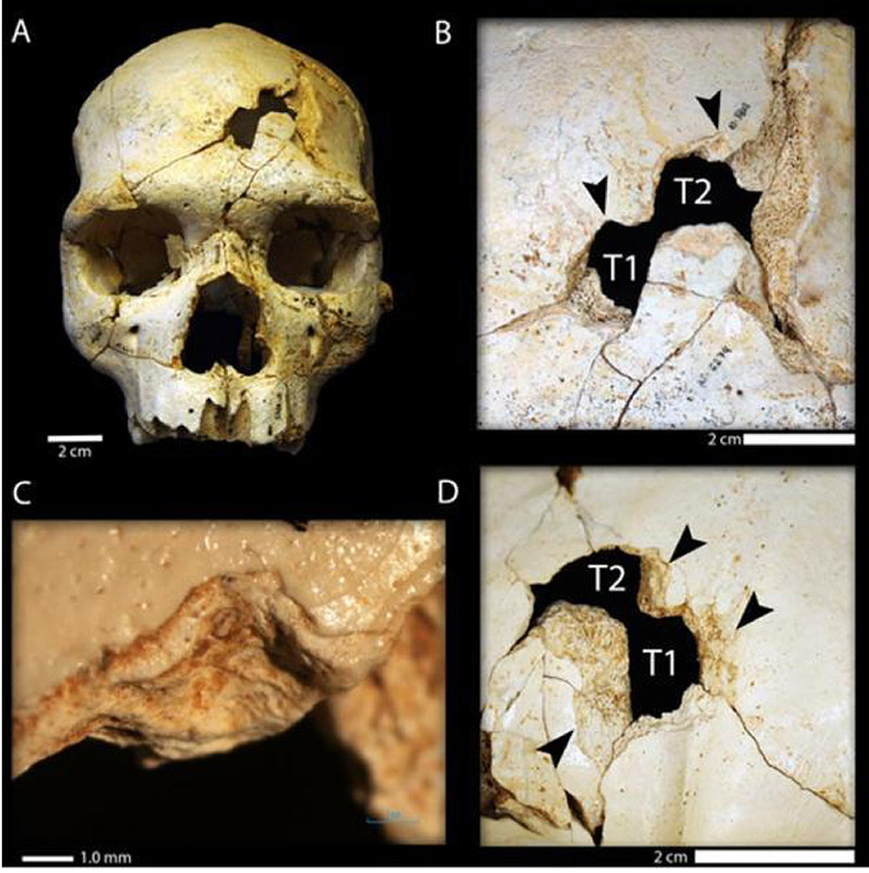 جای ضربه بر جمجمه یک انسان اولیه، آیا یک قتل بوده یا یک حادثه هنگام شکار؟